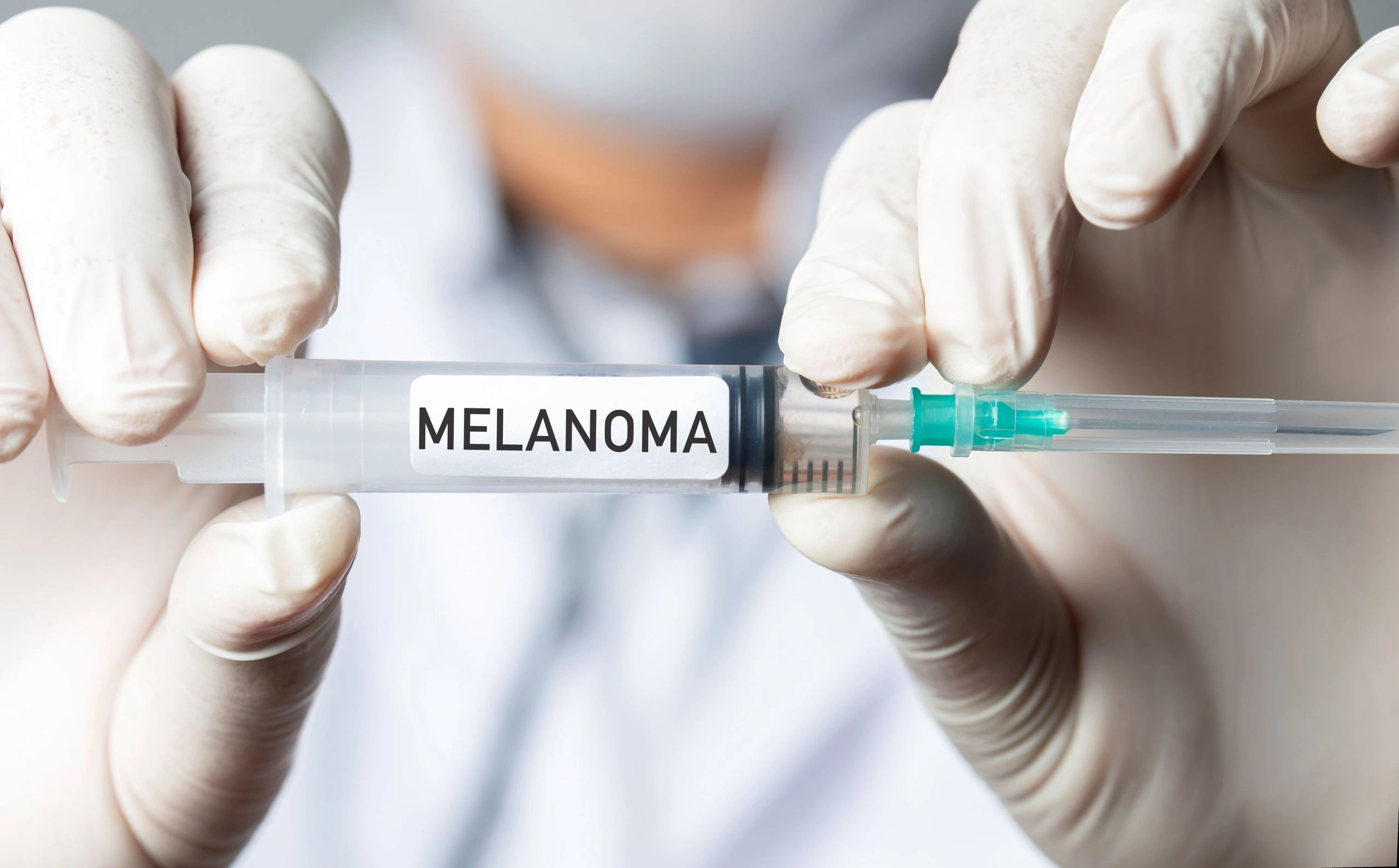 Duas mãos usando luvas seguram uma seringa identificada com a palavra melanoma.
